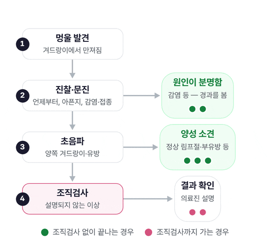 멍울 발견에서 진찰·문진, 초음파, 조직검사, 결과 확인으로 이어지는 흐름도. 진찰에서 원인이 분명해 끝나는 길, 초음파에서 양성 소견으로 끝나는 길, 조직검사까지 가는 길을 두 가지 색의 점이 따라간다