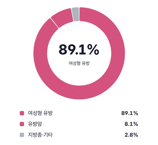 한 병원에서 유방촬영을 받은 남성 248명 중 여성형 유방 89.1%, 유방암 8.1%, 지방종과 기타 질환 2.8%를 보여 주는 도넛 그림