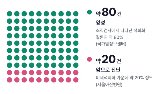 동그라미 100개 가운데 80개가 청록색(양성)으로, 이어서 20개가 분홍색(암으로 진단)으로 차례로 채워지는 그림
